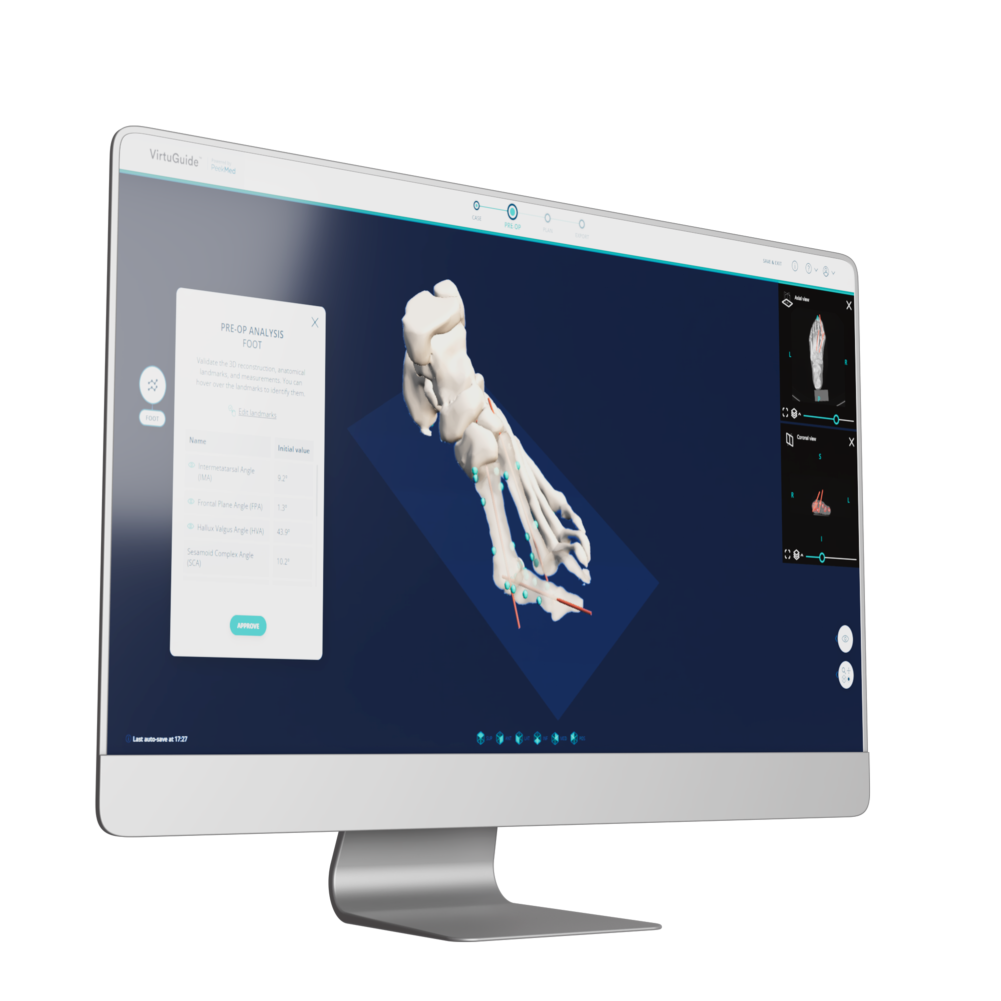 0010_ScreenBlue-high-resolution_PNG